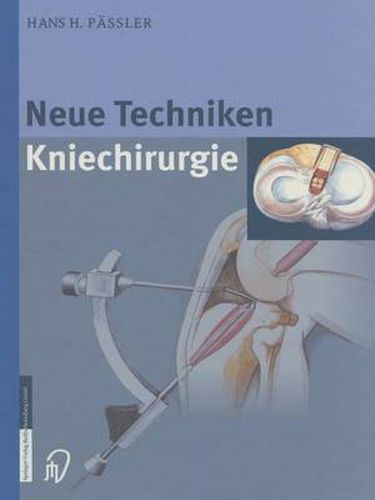 Cover image for Neue Techniken Kniechirurgie