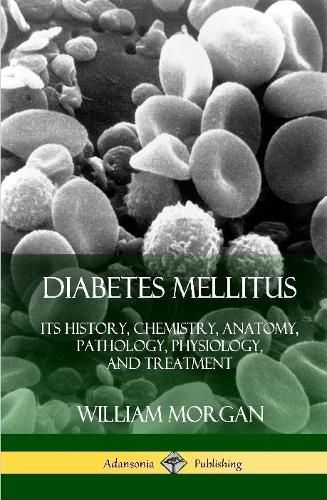 Cover image for Diabetes Mellitus: Its History, Chemistry, Anatomy, Pathology, Physiology, and Treatment (Hardcover)