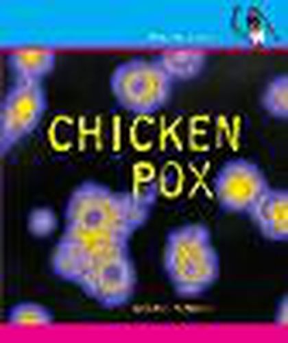 Cover image for Chicken Pox