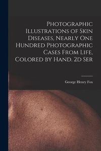 Cover image for Photographic Illustrations of Skin Diseases, Nearly One Hundred Photographic Cases From Life, Colored by Hand. 2d Ser