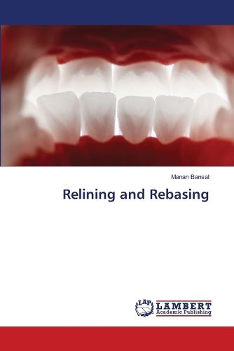 Cover image for Relining and Rebasing