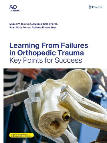 Cover image for Learning From Failures in Orthopedic Trauma: Key Points for Success