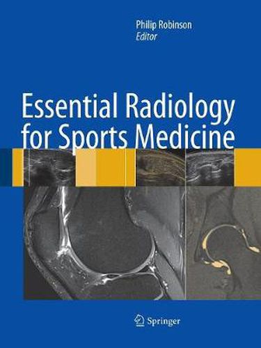 Cover image for Essential Radiology for Sports Medicine