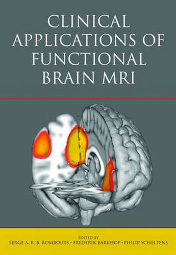 Cover image for Clinical Applications of Functional Brain MRI