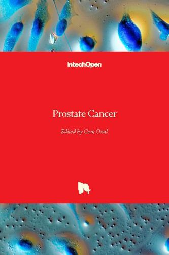 Cover image for Prostate Cancer