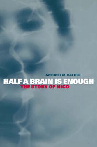 Cover image for Half a Brain is Enough: The Story of Nico