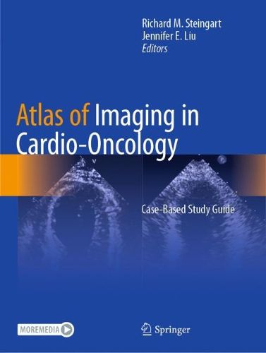 Cover image for Atlas of Imaging in Cardio-Oncology: Case-Based Study Guide