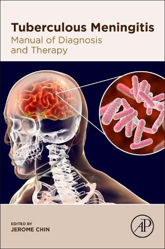 Cover image for Tuberculous Meningitis: Manual of Diagnosis and Therapy