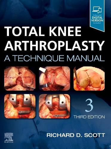 Cover image for Total Knee Arthroplasty: A Technique Manual