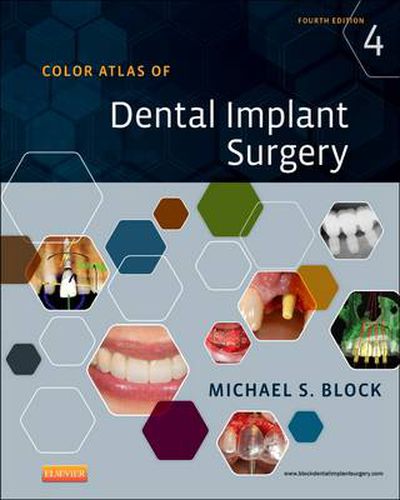 Cover image for Color Atlas of Dental Implant Surgery