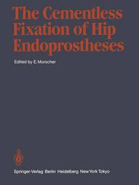 Cover image for The Cementless Fixation of Hip Endoprostheses