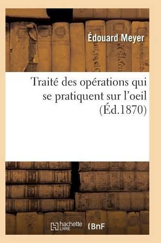 Cover image for Traite Des Operations Qui Se Pratiquent Sur l'Oeil