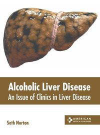 Cover image for Alcoholic Liver Disease: An Issue of Clinics in Liver Disease