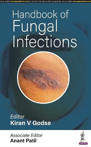 Cover image for Handbook of Fungal Infections