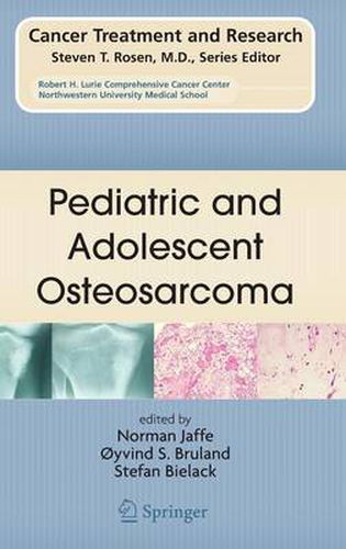 Cover image for Pediatric and Adolescent Osteosarcoma