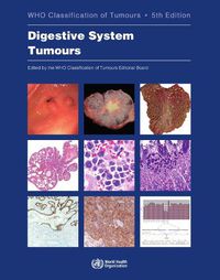 Cover image for WHO Classification of Tumours. Digestive System Tumours: WHO Classification of Tumours, Volume 1
