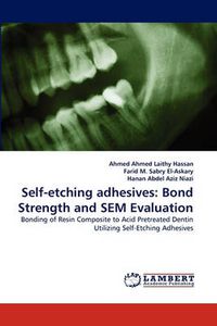 Cover image for Self-Etching Adhesives: Bond Strength and Sem Evaluation