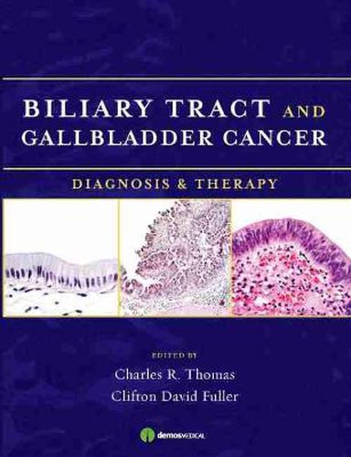 Cover image for Biliary Tract and Gallbladder Cancer: Diagnosis and Therapy