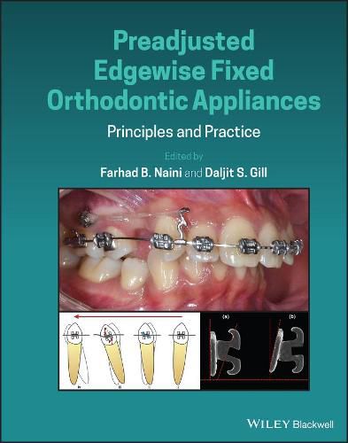 Cover image for Preadjusted Edgewise Fixed Orthodontic Appliances - Principles and Practice