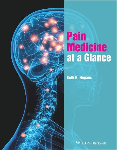 Cover image for Pain Medicine at a Glance