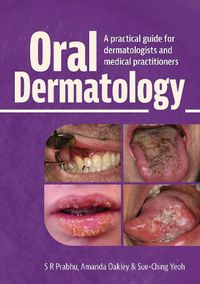 Cover image for Oral Dermatology