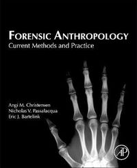 Cover image for Forensic Anthropology: Current Methods and Practice