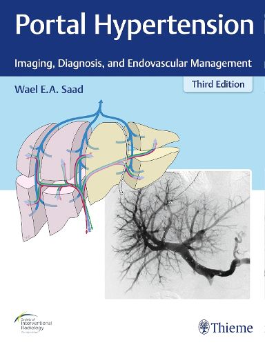 Cover image for Portal Hypertension: Imaging, Diagnosis, and Endovascular Management