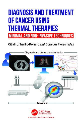 Cover image for Diagnosis and Treatment of Cancer using Thermal Therapies