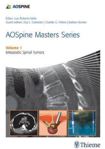 Cover image for AOSpine Masters Series Volume 1: Metastatic Spinal Tumors