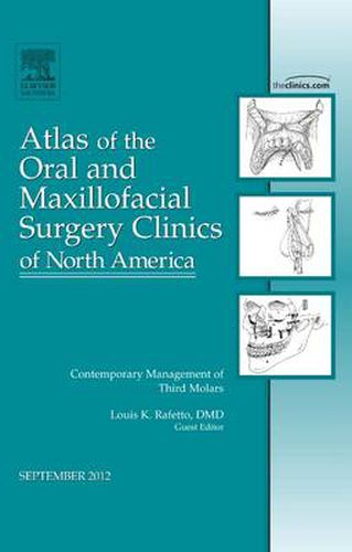 Cover image for Contemporary Management of Third Molars, An Issue of Atlas of the Oral and Maxillofacial Surgery Clinics