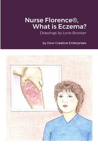 Cover image for Nurse Florence(R), What is Eczema?