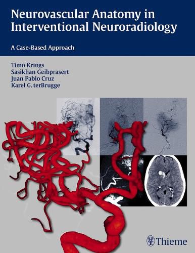 Cover image for Neurovascular Anatomy in Interventional Neuroradiology: A Case-Based Approach