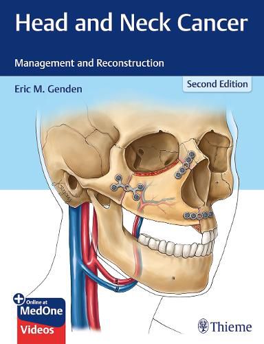 Cover image for Head and Neck Cancer: Management and Reconstruction