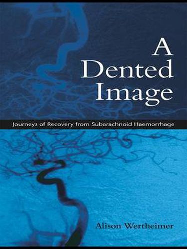 Cover image for A Dented Image: Journeys of Recovery from Subarachnoid Haemorrhage