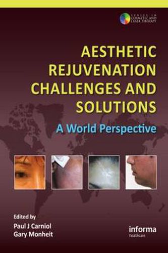 Cover image for Aesthetic Rejuvenation Challenges and Solutions: A World Perspective