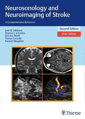 Cover image for Neurosonology and Neuroimaging of Stroke: A Comprehensive Reference