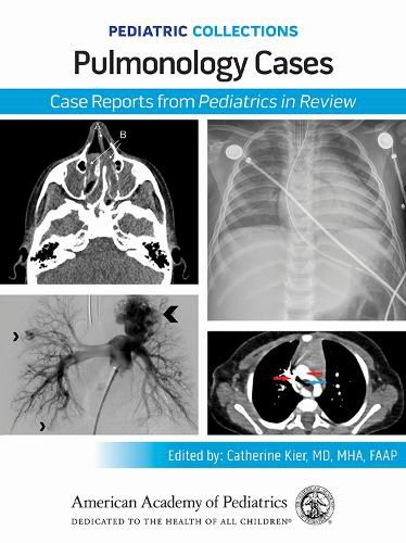 Cover image for Pediatric Collections: Pulmonology Cases: Case Reports from Pediatrics in Review