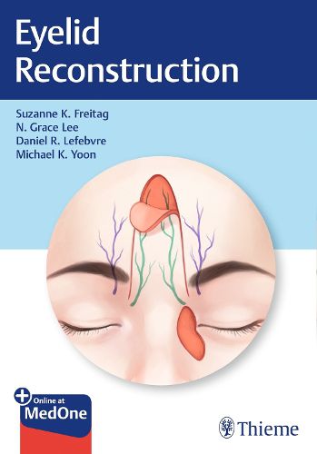 Cover image for Eyelid Reconstruction
