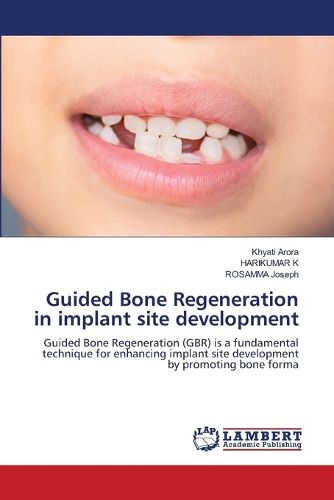 Cover image for Guided Bone Regeneration in implant site development