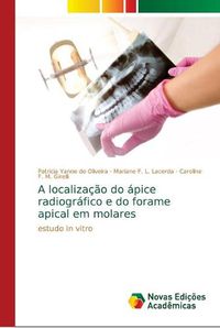 Cover image for A localizacao do apice radiografico e do forame apical em molares