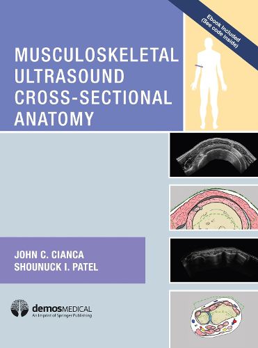 Cover image for Musculoskeletal Ultrasound Cross-Sectional Anatomy