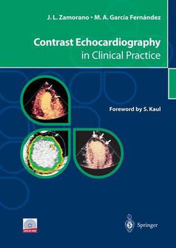 Cover image for Contrast Echocardiography in Clinical Practice