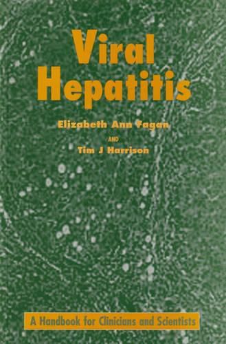 Cover image for Viral Hepatitis