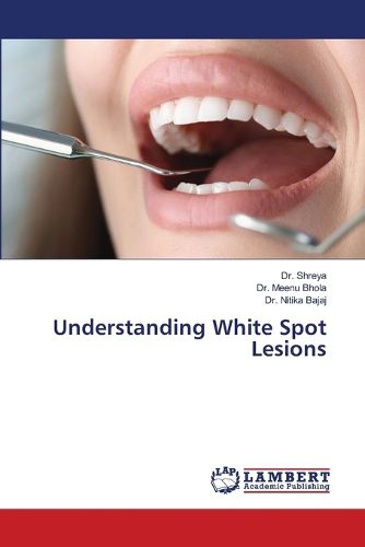 Cover image for Understanding White Spot Lesions