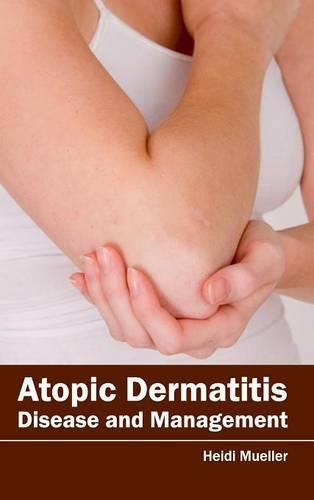 Cover image for Atopic Dermatitis: Disease and Management