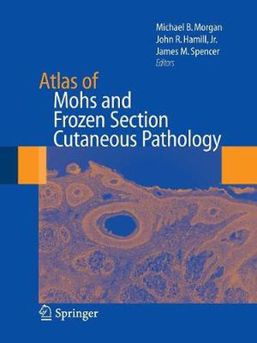 Atlas of Mohs and Frozen Section Cutaneous Pathology