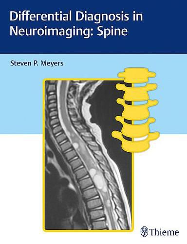 Cover image for Differential Diagnosis in Neuroimaging: Spine