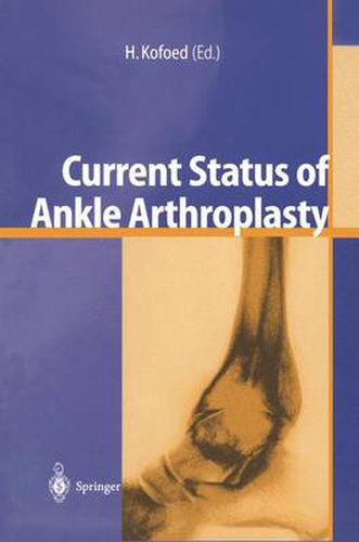 Cover image for Current Status of Ankle Arthroplasty