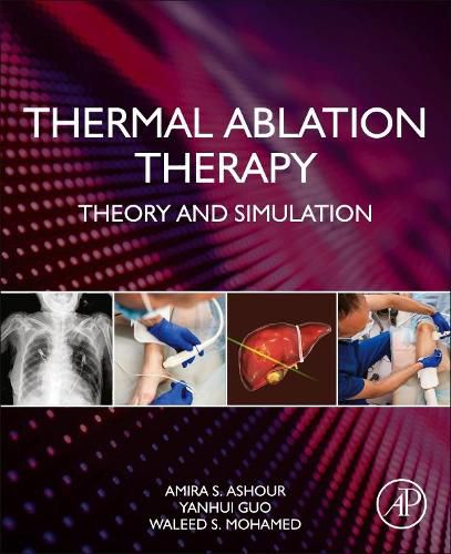 Cover image for Thermal Ablation Therapy: Theory and Simulation