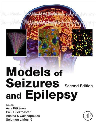 Cover image for Models of Seizures and Epilepsy